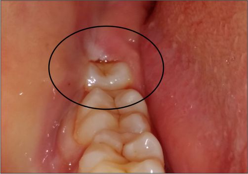 Trusted dental care hub in Rajkot you can rely on Trusted dental care hub in Rajkot you can rely on