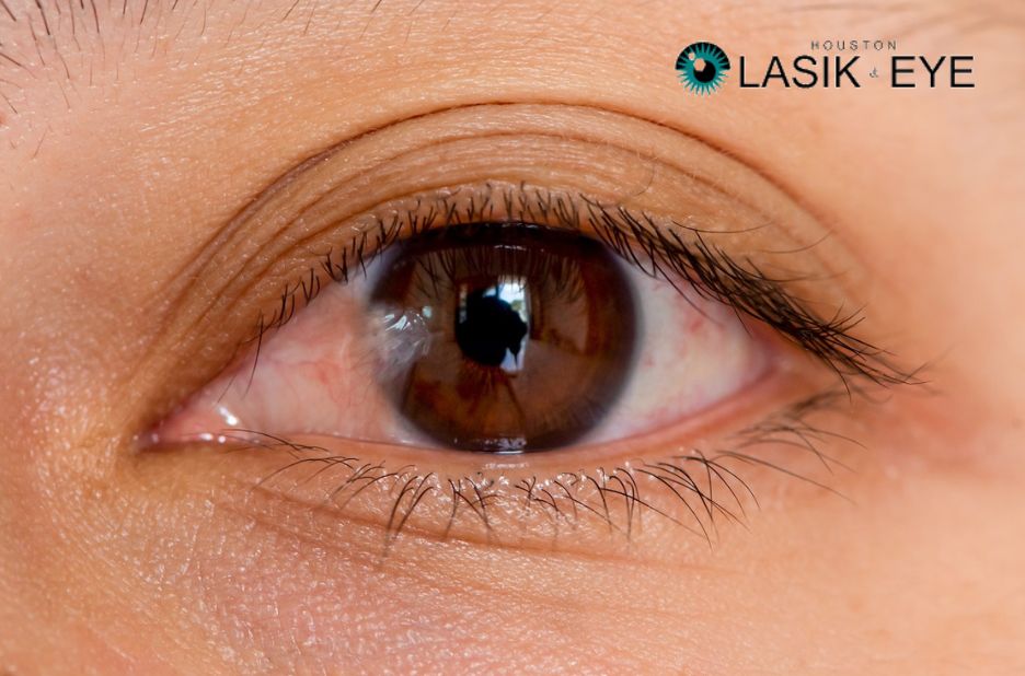 What to Expect After Pterygium Treatment: A Patient Guide What to Expect After Pterygium Treatment: A Patient Guide