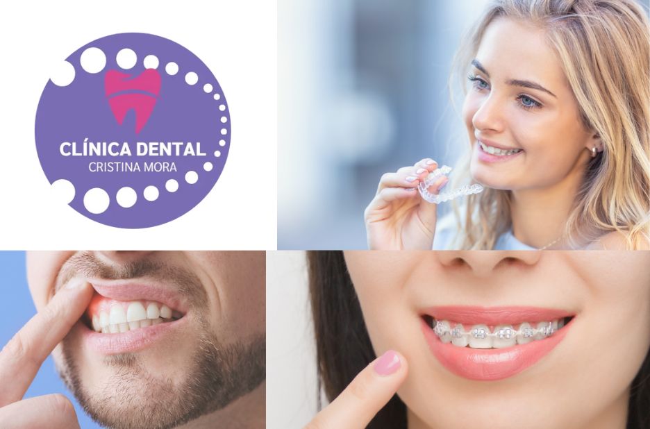 Somriures brillants: com cuidar la salut dental a Gines Somriures brillants: com cuidar la salut dental a Gines