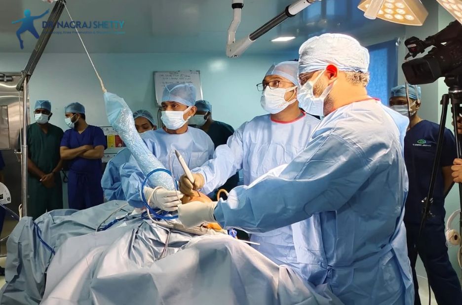 Top Shoulder Surgery Experts in India for 2026 Top Shoulder Surgery Experts in India for 2026