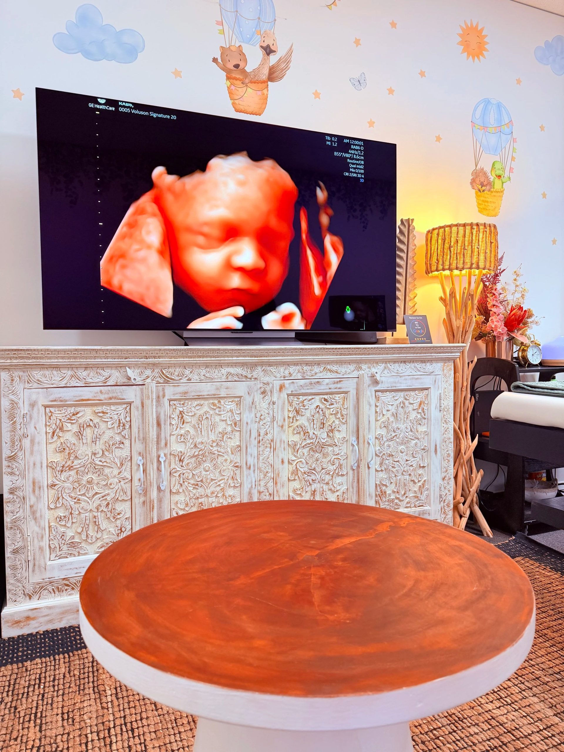A practical guide to trusted prenatal scans in Perth A practical guide to trusted prenatal scans in Perth