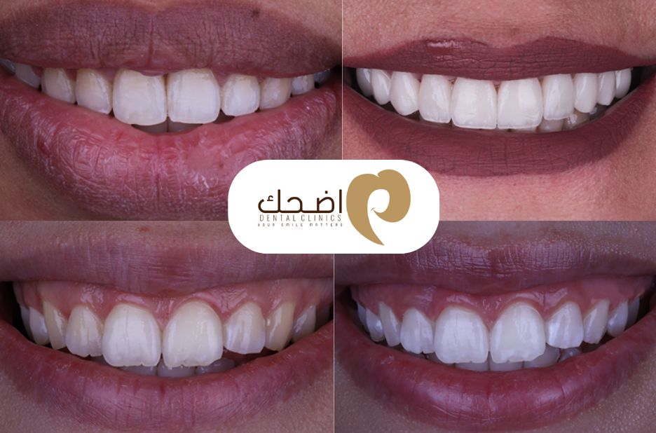 ابتسامة صحية: دليل شامل للعناية بالفم والأسنان بثقة ابتسامة صحية: دليل شامل للعناية بالفم والأسنان بثقة