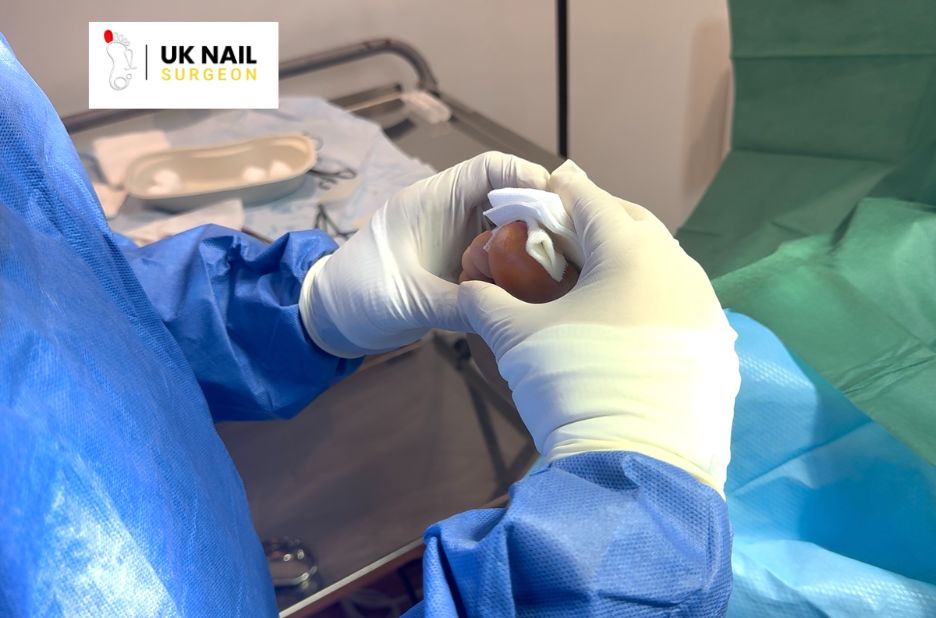 Fast Relief for Toe Troubles Near You Fast Relief for Toe Troubles Near You