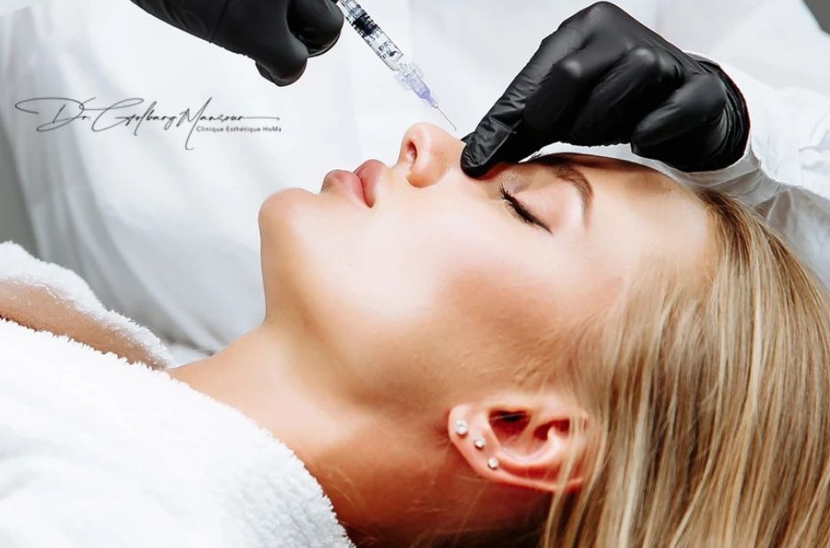 Trusted Wrinkle Filler Clinics in Montreal Buyer’s Guide Trusted Wrinkle Filler Clinics in Montreal Buyer’s Guide